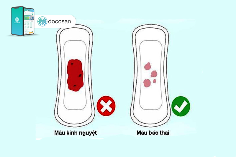 Máu Báo Thai - Thời điểm thường gặp và kéo dài bao lâu? Máu Báo Thai - Thời điểm thường gặp và kéo dài bao lâu?