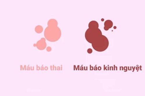 Máu Báo Thai - Những nguyên nhân bác sĩ thường cân nhắc Máu Báo Thai - Những nguyên nhân bác sĩ thường cân nhắc
