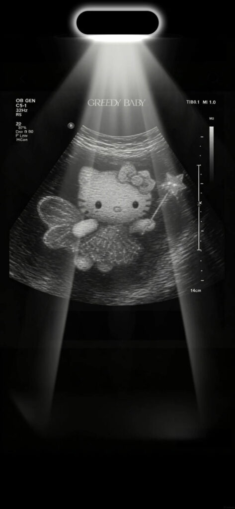 Ảnh Hello Kitty - 28
